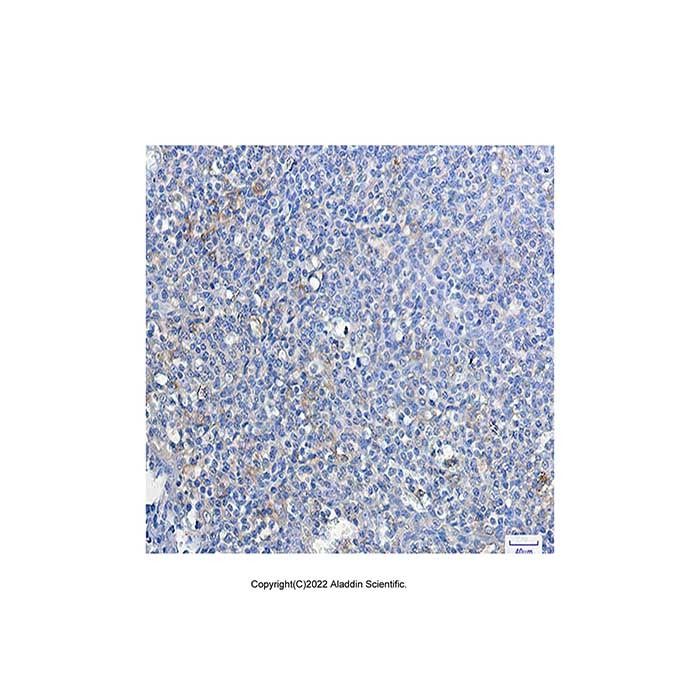 Recombinant ATG3 Antibody -    by Aladdin Scientific