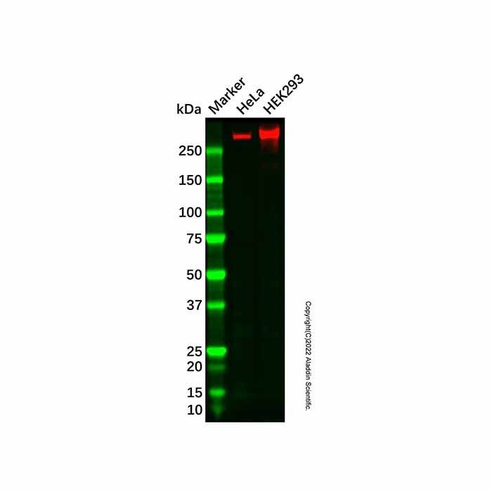 Recombinant ATM Antibody -    by Aladdin Scientific