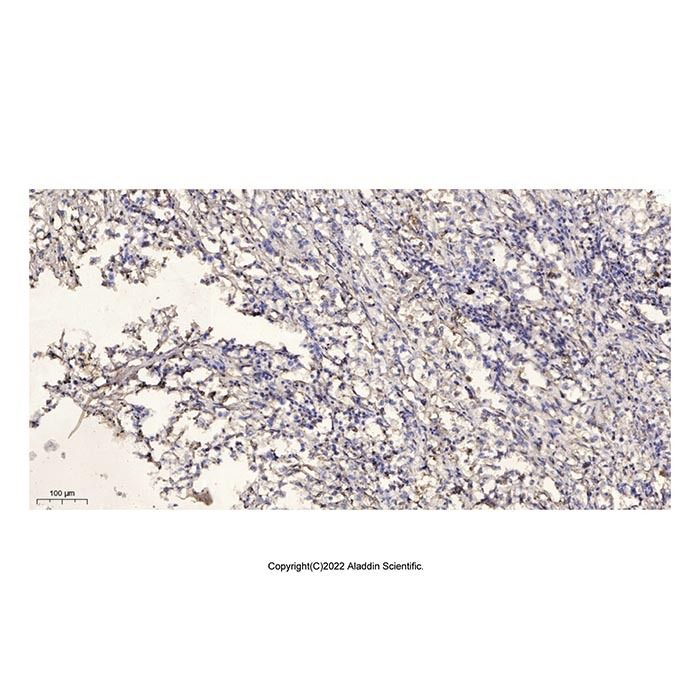 ATP5H Antibody -    by Aladdin Scientific