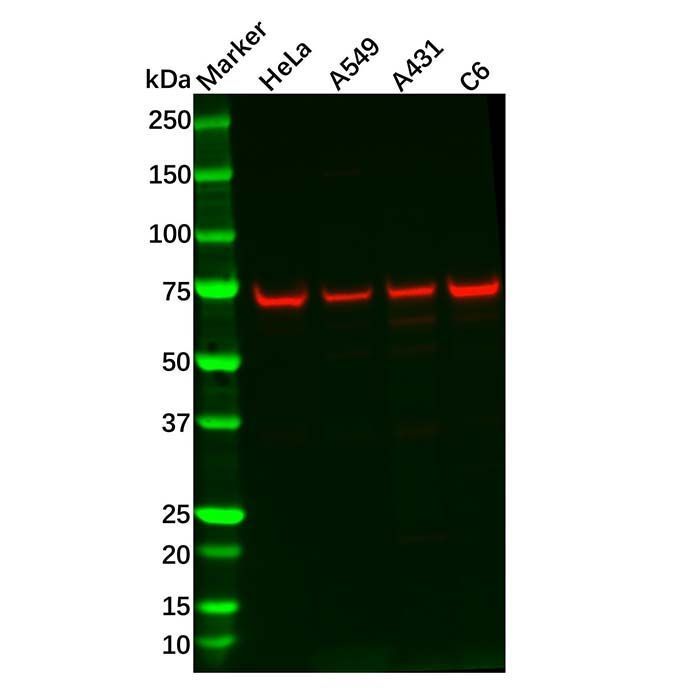 Recombinant ATP6V1A Antibody -    by Aladdin Scientific