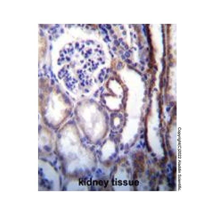ATP6V1B1 Antibody -    by Aladdin Scientific