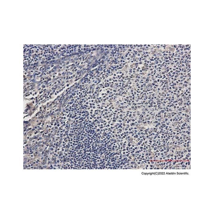 ATP6V1E1 Antibody -    by Aladdin Scientific