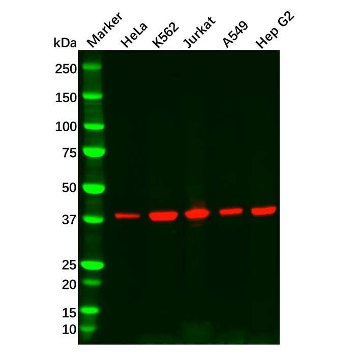 Recombinant Aurora B Antibody -    by Aladdin Scientific