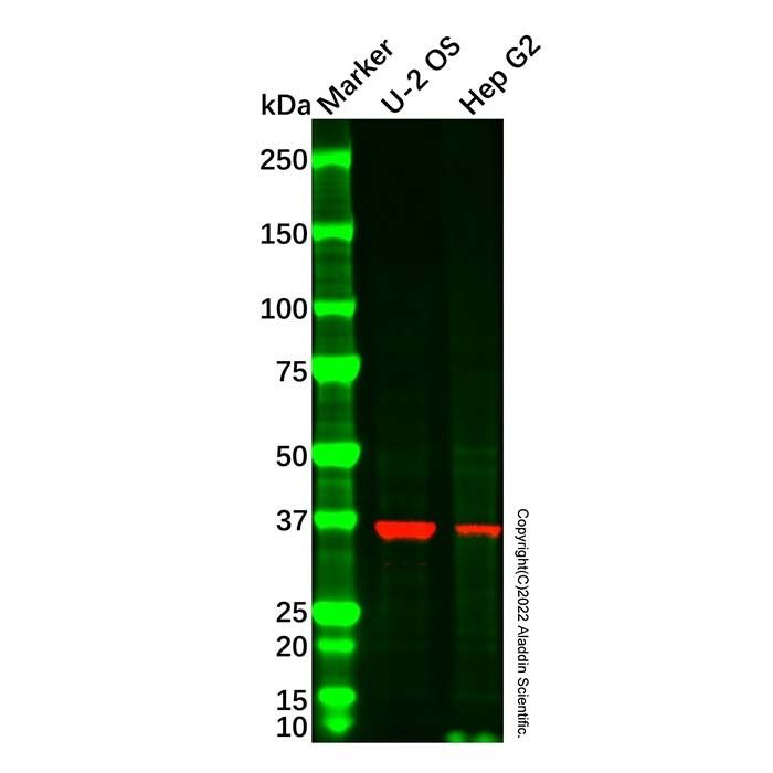 B4GALT4 Antibody -    by Aladdin Scientific