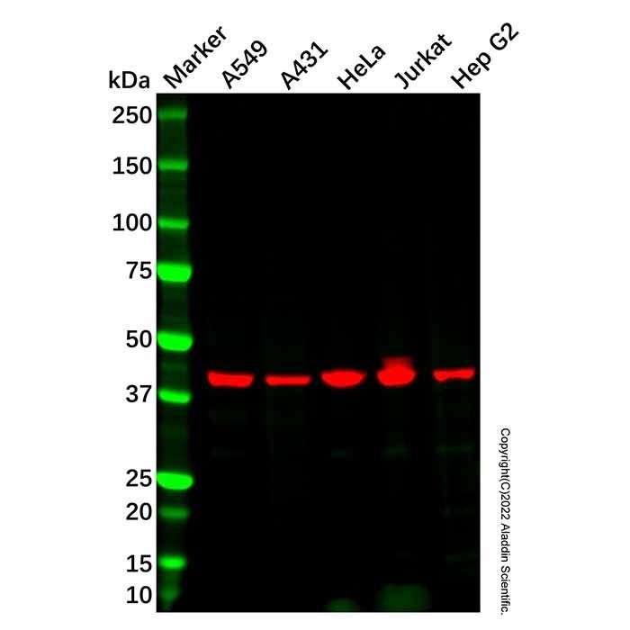 BAAT Antibody -    by Aladdin Scientific