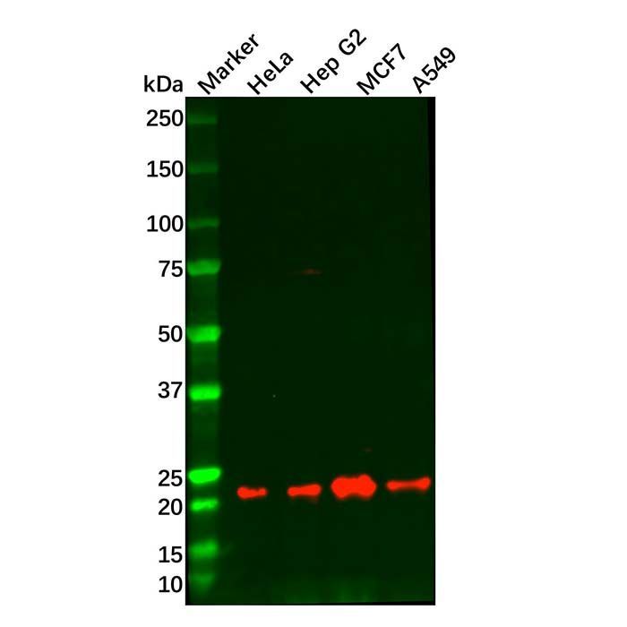 Recombinant Bad Antibody -    by Aladdin Scientific