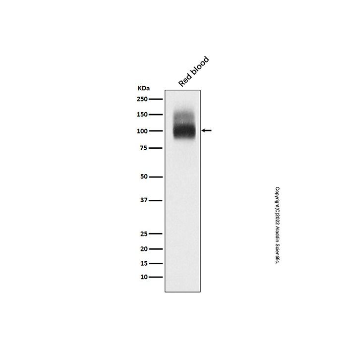 Recombinant Band 3/AE 1 Antibody -    by Aladdin Scientific