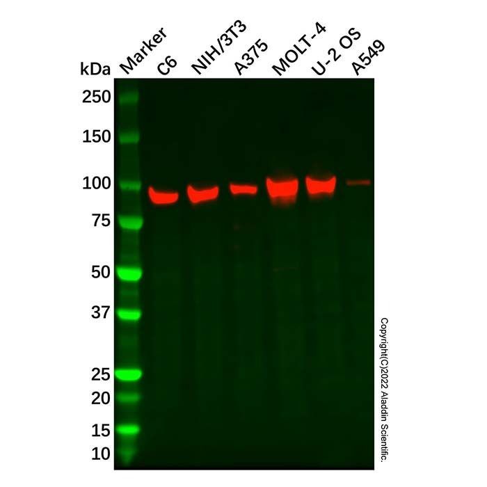 Recombinant BAP1 Antibody -    by Aladdin Scientific