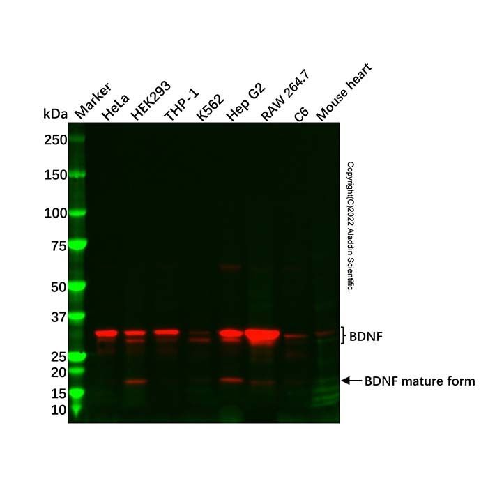 BDNF Antibody -    by Aladdin Scientific