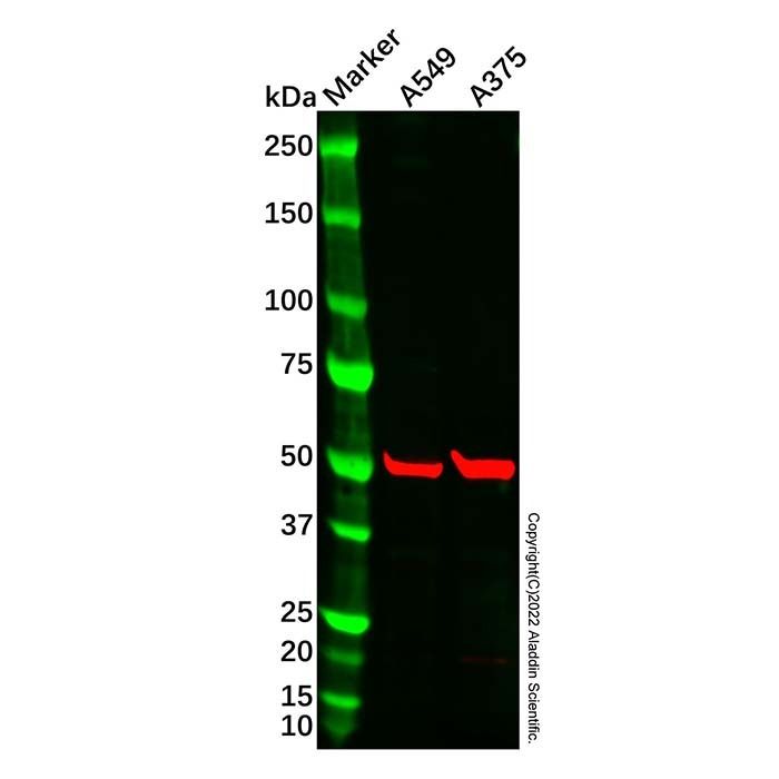 beta 1 Adrenergic Receptor Antibody -    by Aladdin Scientific