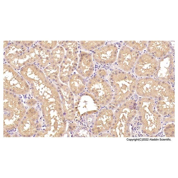 Beta 2 Microglobulin Mouse mAb -    by Aladdin Scientific