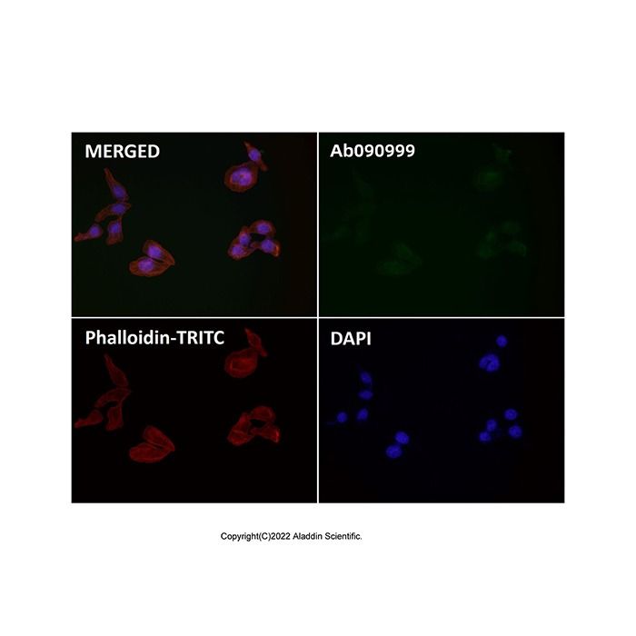 Recombinant beta Actin Antibody -    by Aladdin Scientific