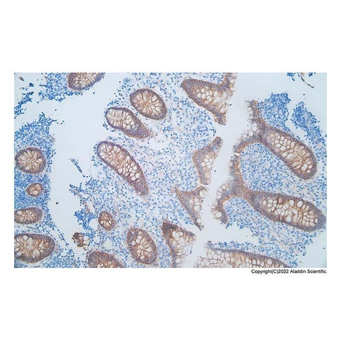 Recombinant beta Catenin Antibody -    by Aladdin Scientific