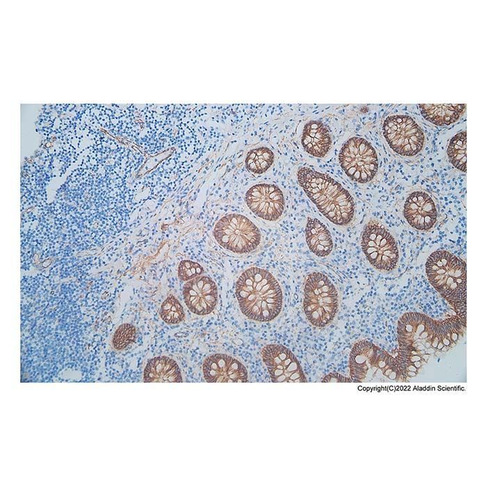 Recombinant beta Catenin Antibody -    by Aladdin Scientific