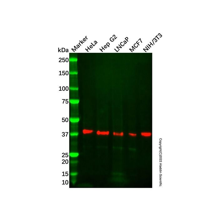 Recombinant beta Dystroglycan Antibody -    by Aladdin Scientific
