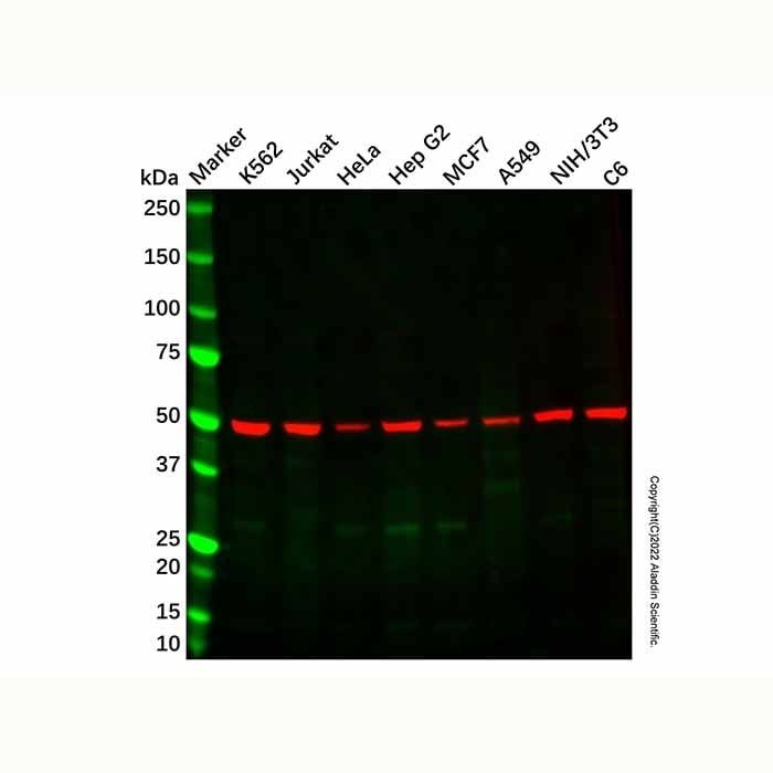 Recombinant beta I Tubulin Antibody -    by Aladdin Scientific