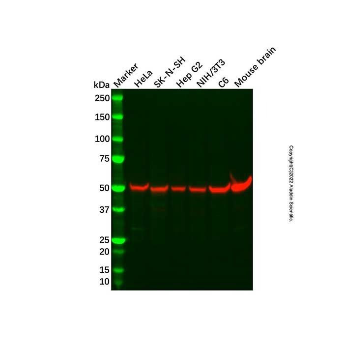 beta III Tubulin Mouse mAb -    by Aladdin Scientific