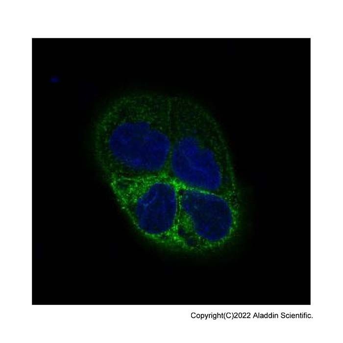 Recombinant beta III Tubulin Antibody -    by Aladdin Scientific