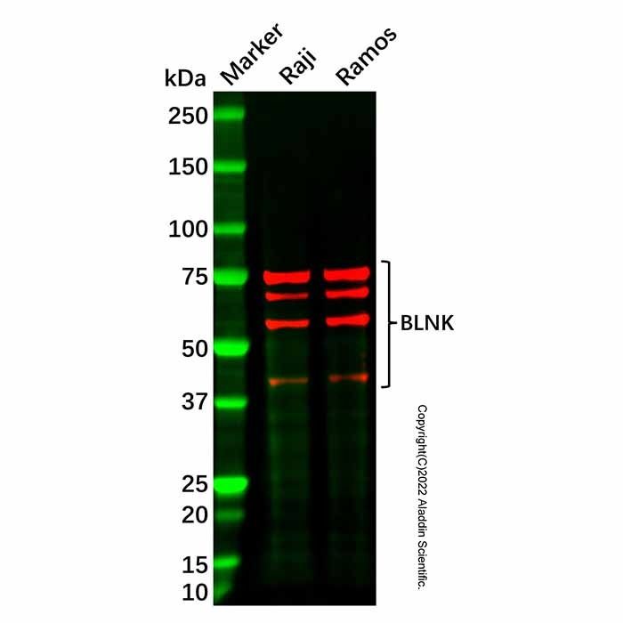 Recombinant BLNK Antibody -    by Aladdin Scientific