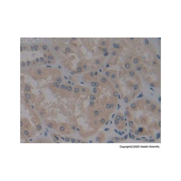 Bmf Antibody -    by Aladdin Scientific