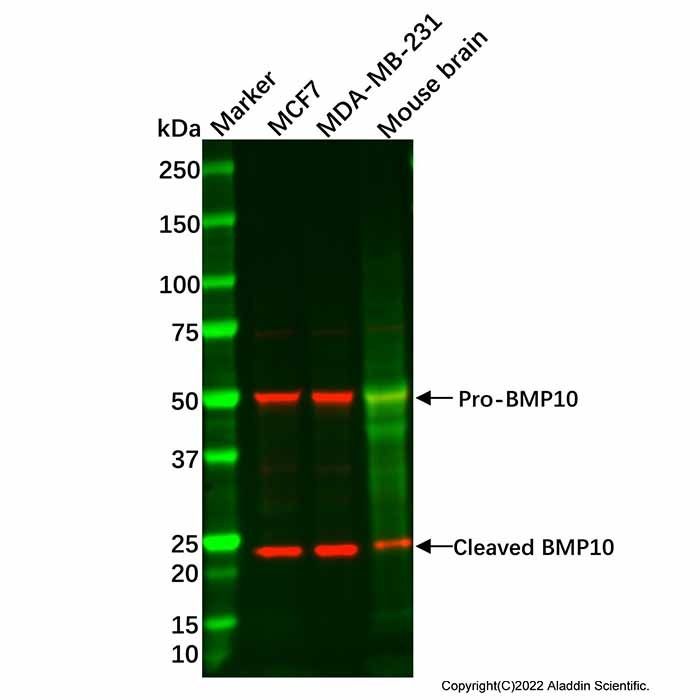 BMP10 Antibody -    by Aladdin Scientific