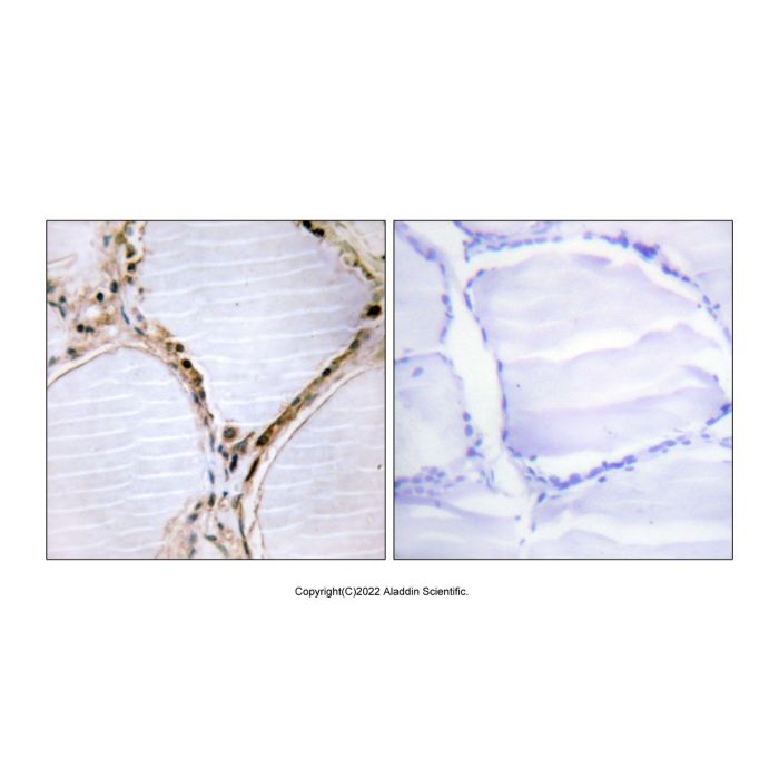 BMX Antibody -    by Aladdin Scientific