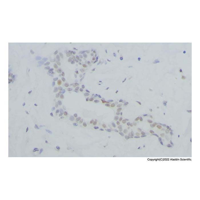 Recombinant BRCA1 Antibody -    by Aladdin Scientific