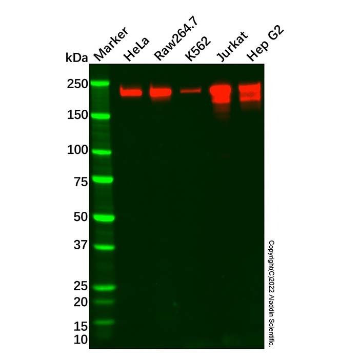 BRG1 Mouse mAb -    by Aladdin Scientific
