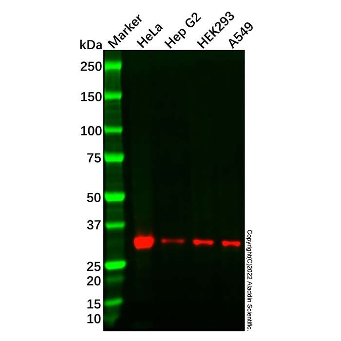 Recombinant BRMS1 Antibody -    by Aladdin Scientific