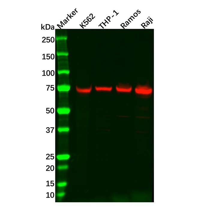 Recombinant BTK Antibody -    by Aladdin Scientific