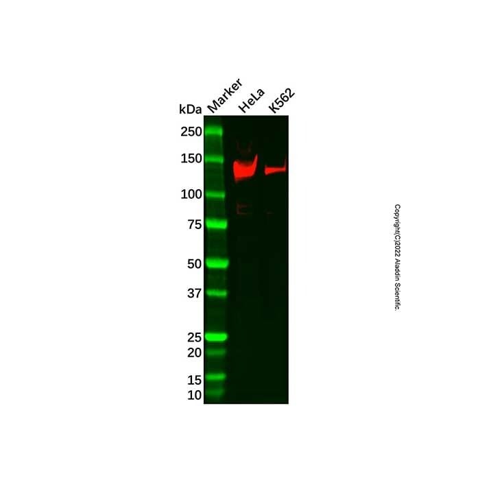 Recombinant Bub1 Antibody -    by Aladdin Scientific
