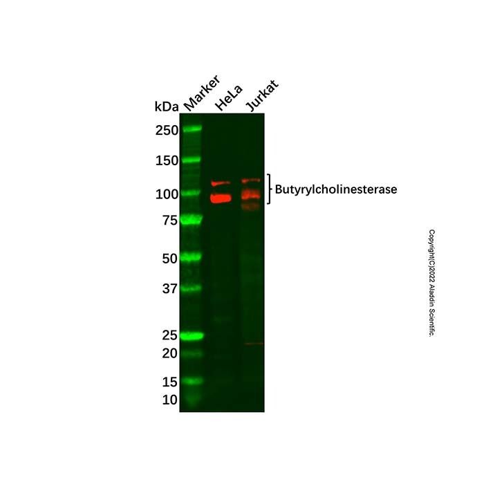 Recombinant Butyrylcholinesterase Antibody -    by Aladdin Scientific