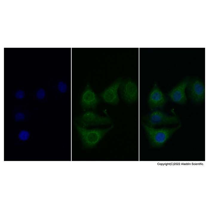 C1s Mouse mAb - by Aladdin Scientific