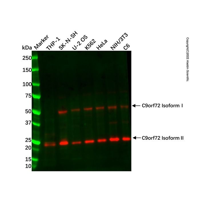 C9orf72 Antibody -    by Aladdin Scientific