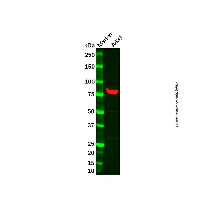 Recombinant Calpain 1 Antibody -    by Aladdin Scientific