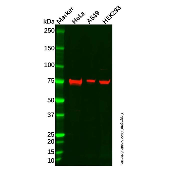 Calpain 2 Antibody -    by Aladdin Scientific