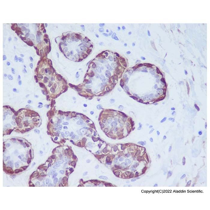 Calponin 1 Antibody -    by Aladdin Scientific