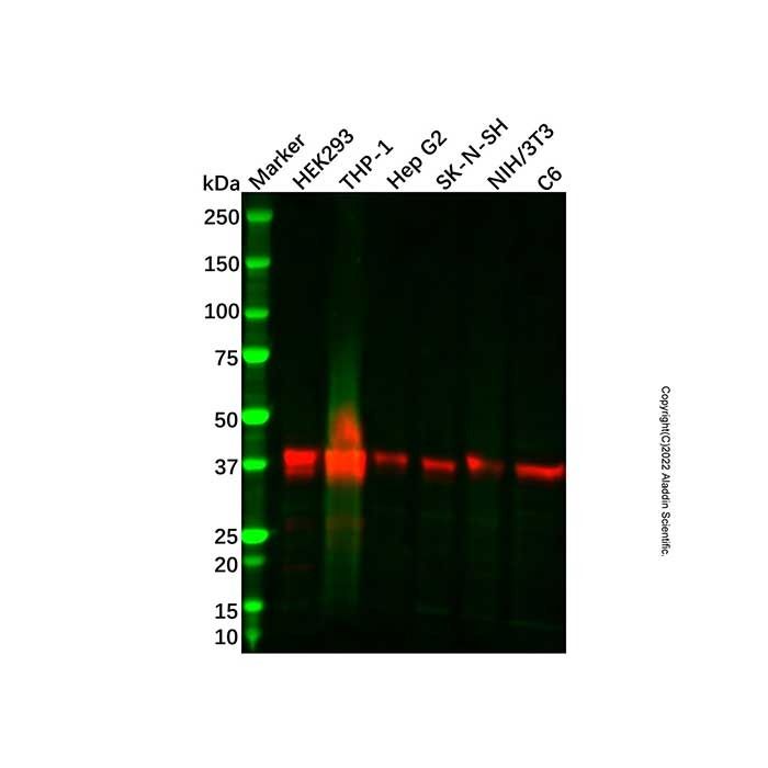 Recombinant CaMKI Antibody -    by Aladdin Scientific