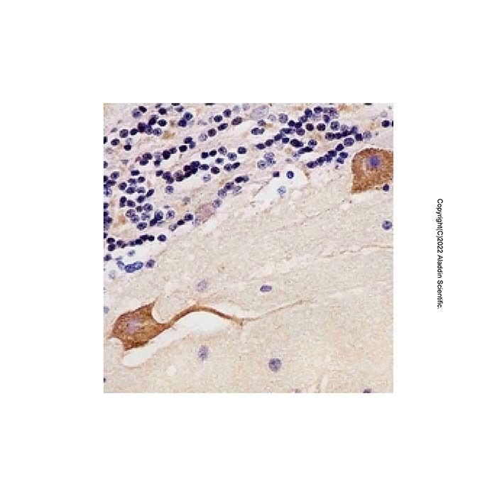 CAMK2B Mouse mAb -    by Aladdin Scientific