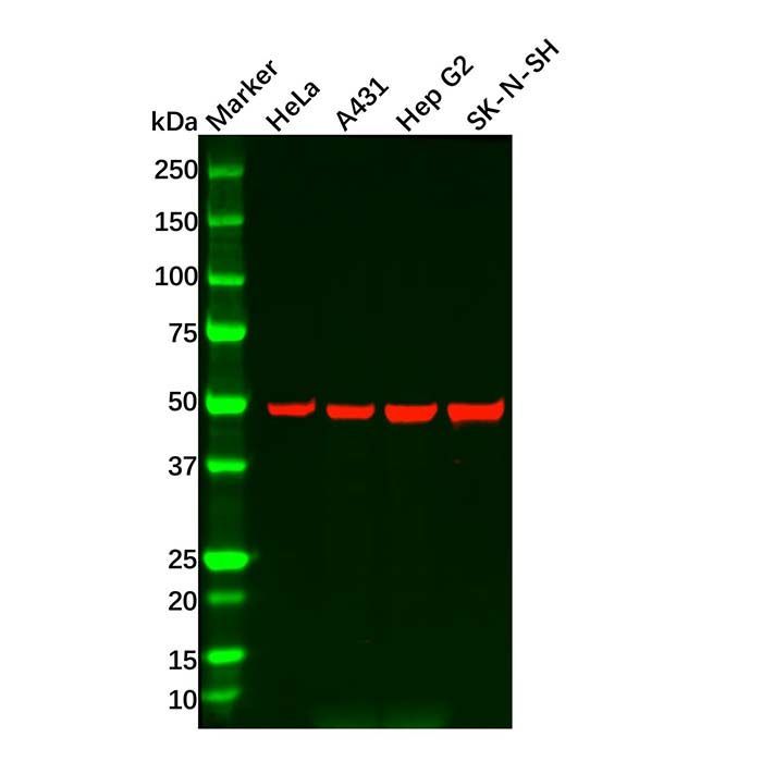Recombinant CaMKII delta Antibody -    by Aladdin Scientific