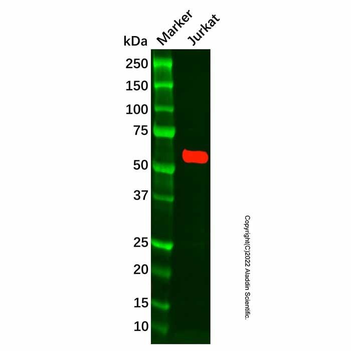 Recombinant CAMKIV Antibody -    by Aladdin Scientific