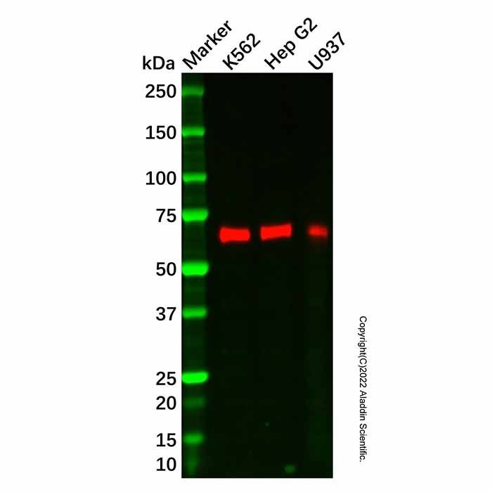 Recombinant CARD9 Antibody -    by Aladdin Scientific