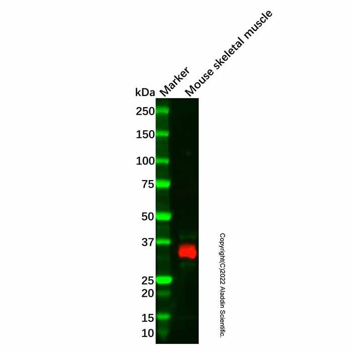 Recombinant Cardiac Troponin T Antibody -    by Aladdin Scientific