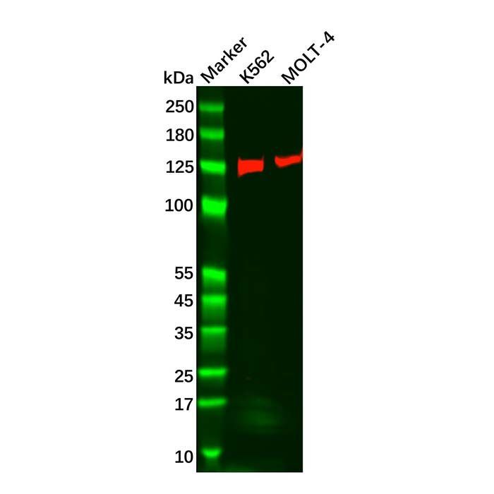 Recombinant Carma 1/CARD11 Antibody -    by Aladdin Scientific