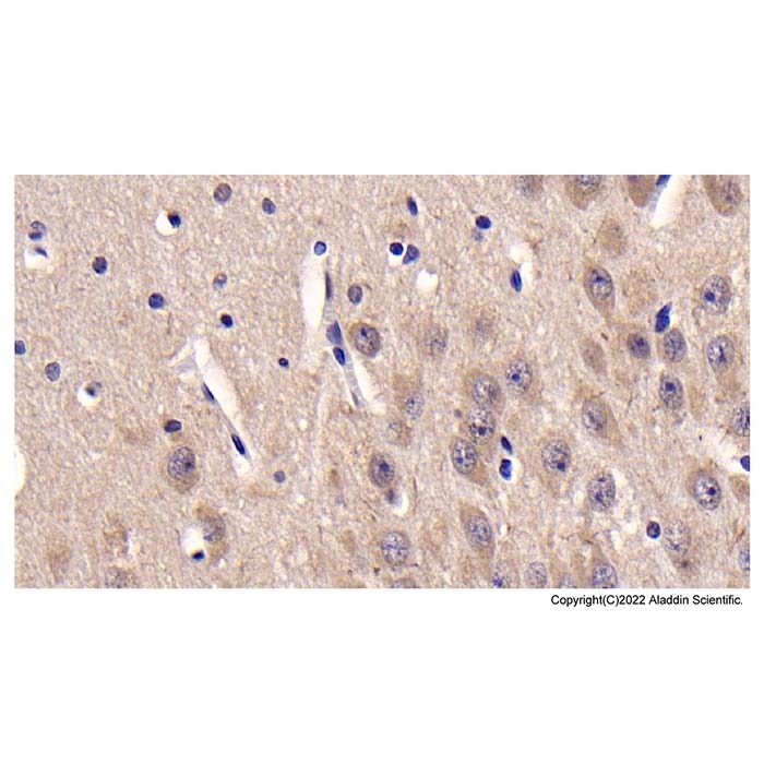 Casein Kinase 1 delta/CSNK1D Mouse mAb - by Aladdin Scientific