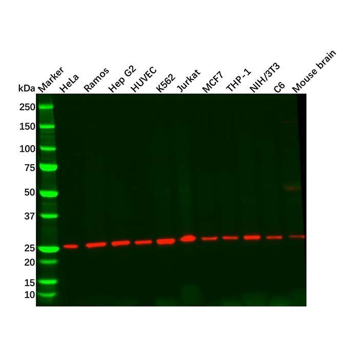 Recombinant Casein Kinase 2 beta Antibody -    by Aladdin Scientific