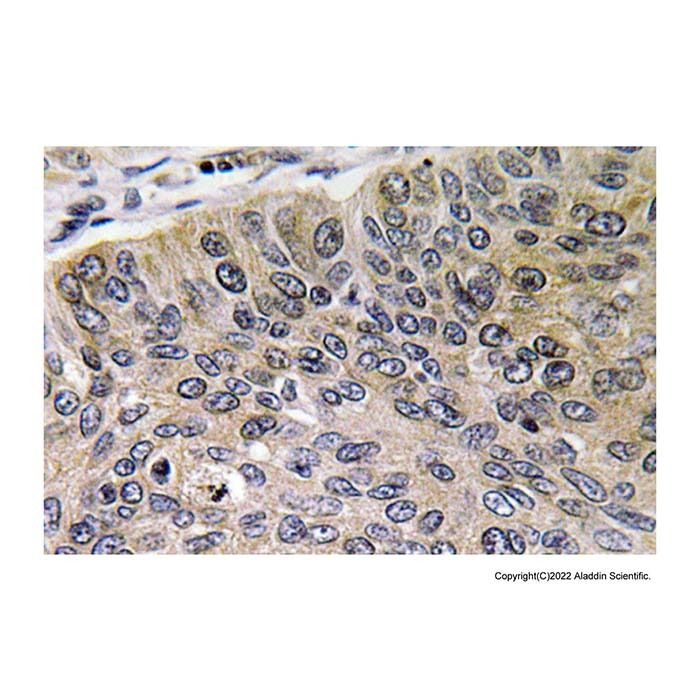 Cathepsin E Antibody -    by Aladdin Scientific