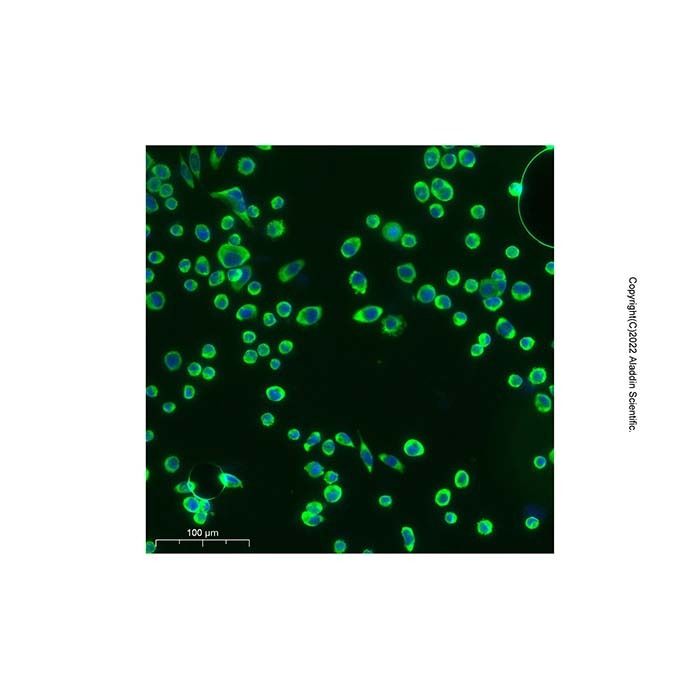 Cathepsin V Antibody -    by Aladdin Scientific