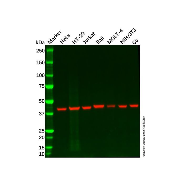 CCR6 Antibody -    by Aladdin Scientific