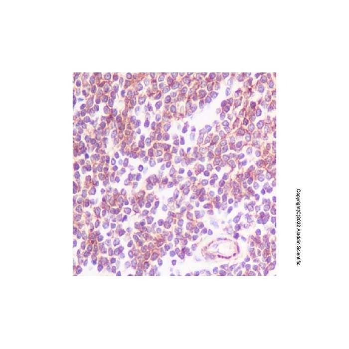 Recombinant CCR7 Antibody -    by Aladdin Scientific